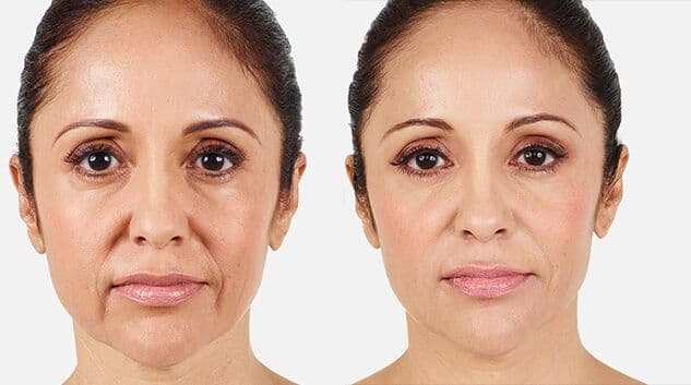 Injectable treatment results