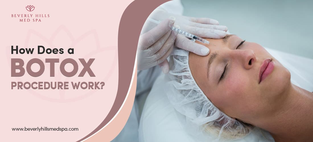 How Does a Botox Procedure Work?