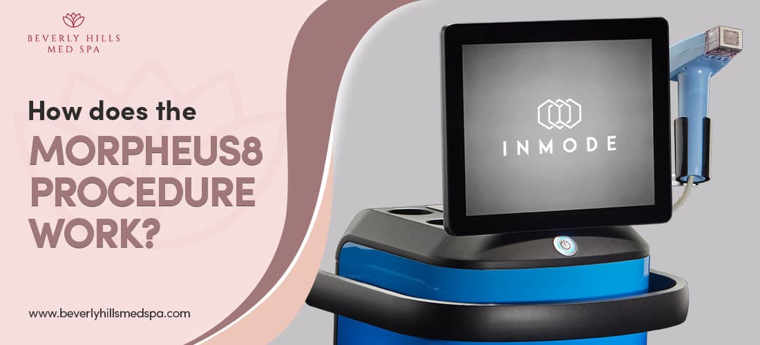 How does the Morpheus8 procedure work?