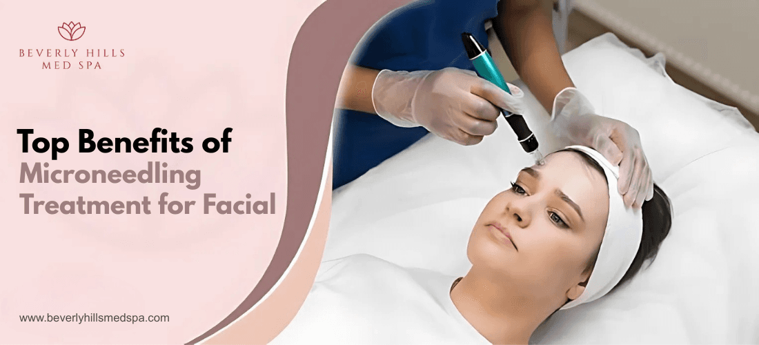 Top Benefits of Microneedling Treatment for Facial 