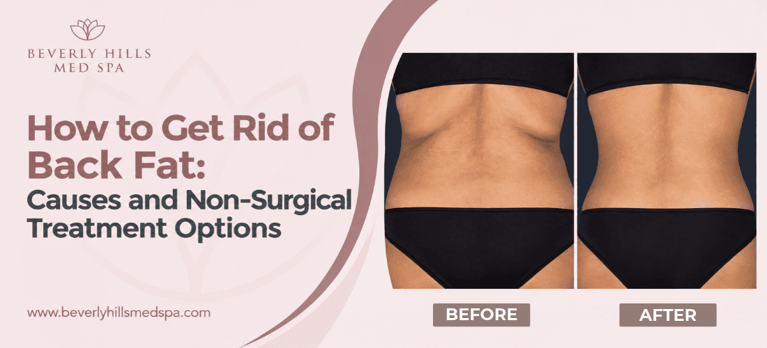how-to-get-rid-of-back-fat