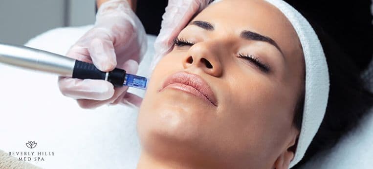Is Microneedling Treatment Worth The Money?