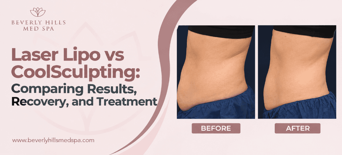 laser-lipo-vs-coolsculpting