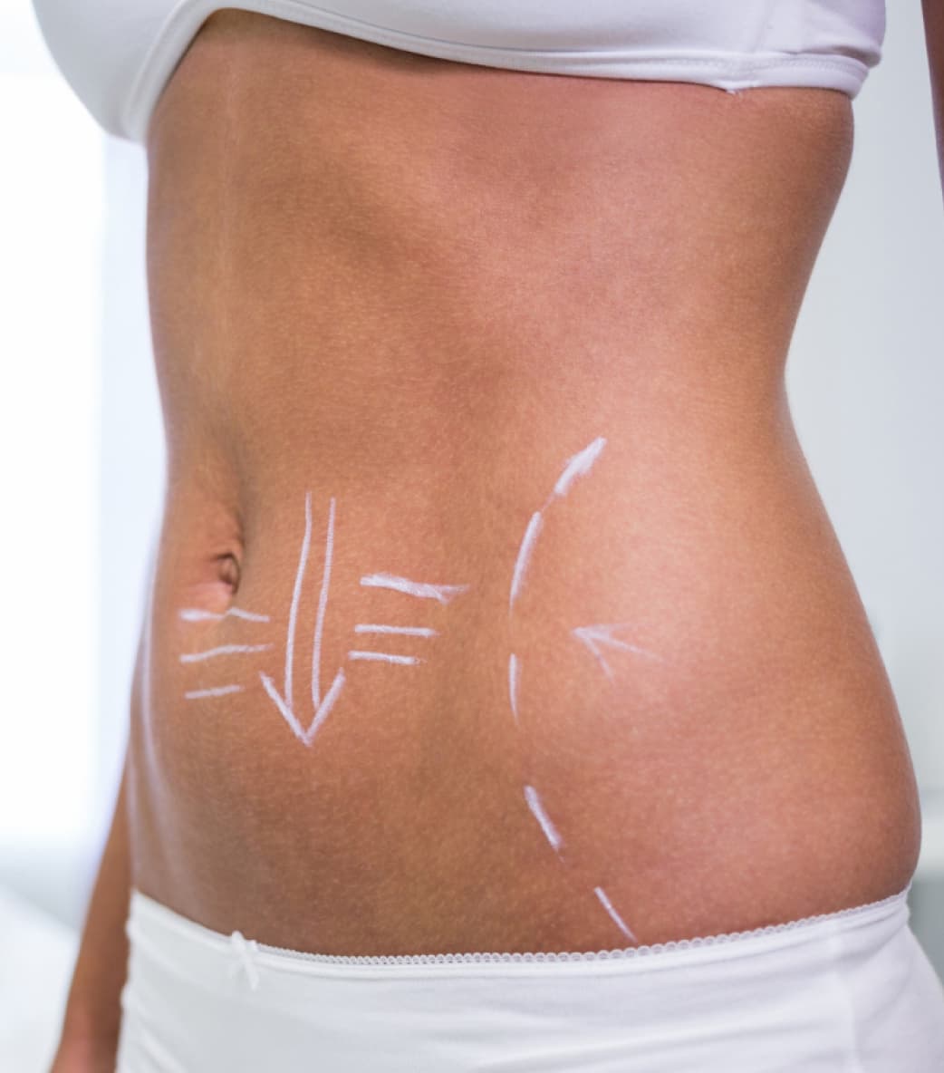 Why Choose CoolSculpting