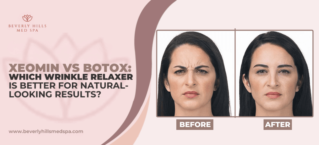 xeomin-vs-botox