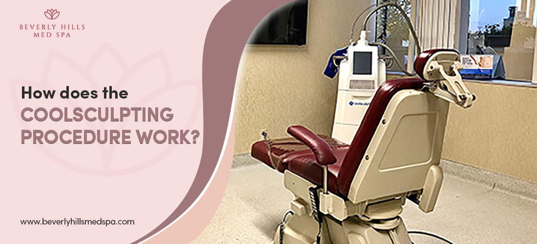 How does the CoolSculpting Procedure work Featured Image