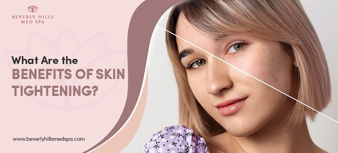What Are the Benefits of Skin Tightening?