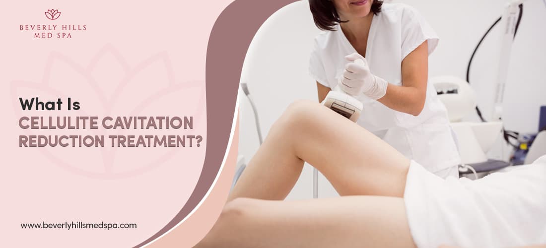What Is Cellulite Cavitation Reduction Treatment?