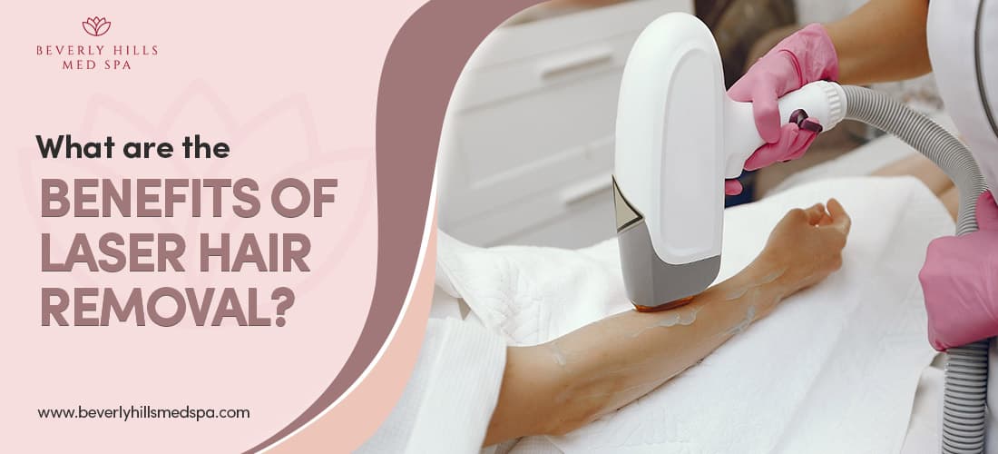 What are the benefits of laser hair removal ?