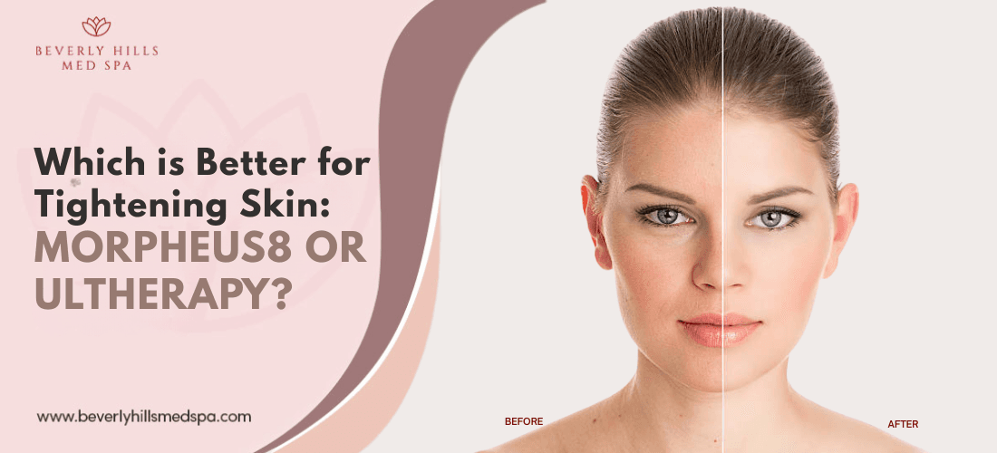 Which is Better for Skin Tightening: Morpheus8 vs Ultherapy?