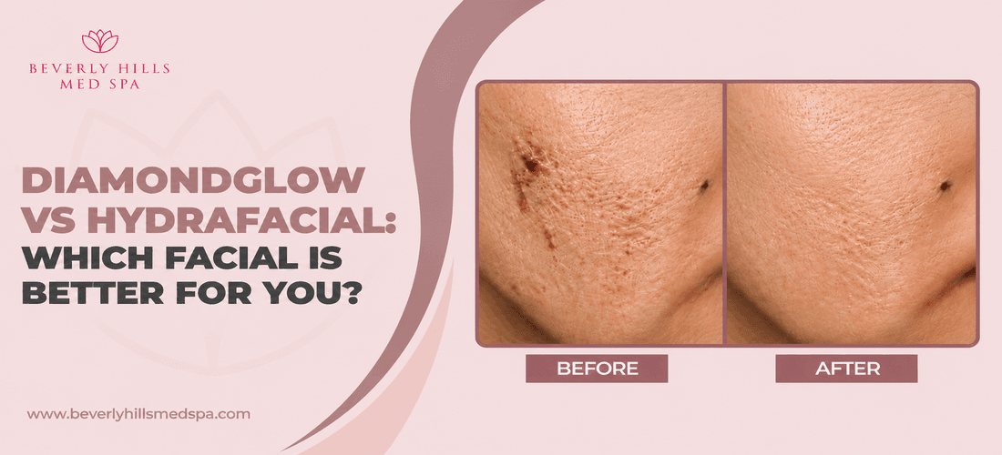 diamondglow-vs-hydrafacial