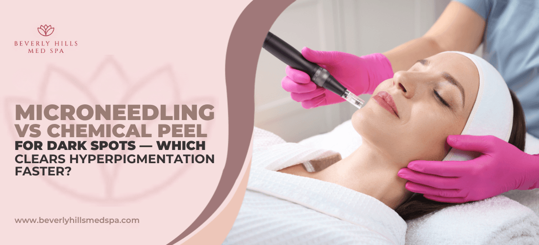 microneedling-vs-chemical-peel-for-dark-spots