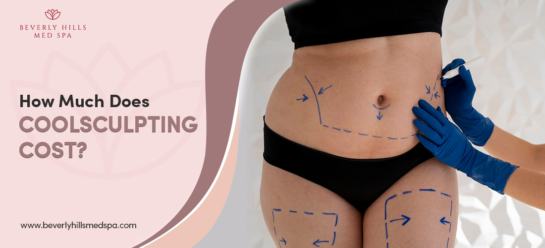 CoolSculpting Cost