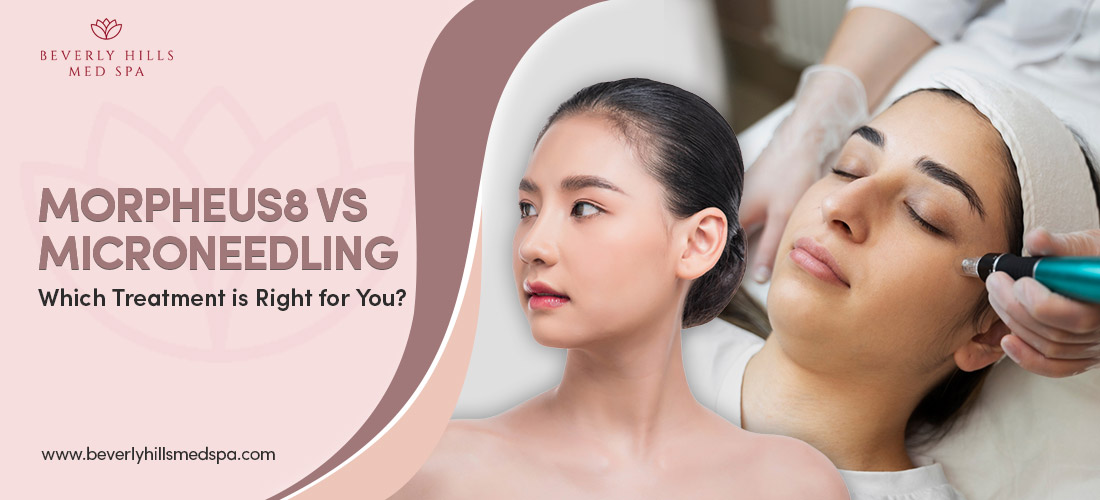 Morpheus8 vs Microneedling