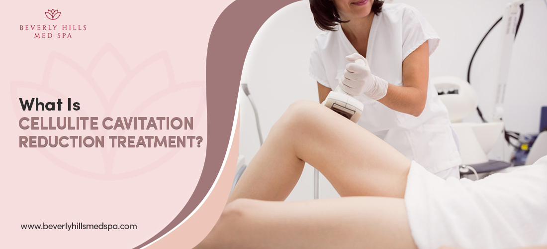 what isn cellulite cavitation reduction treatment