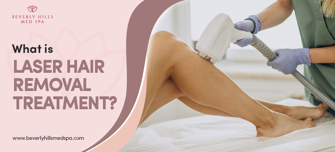 What is laser hair removal