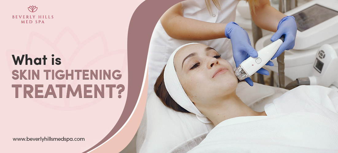 What is Skin Tightening Treatment