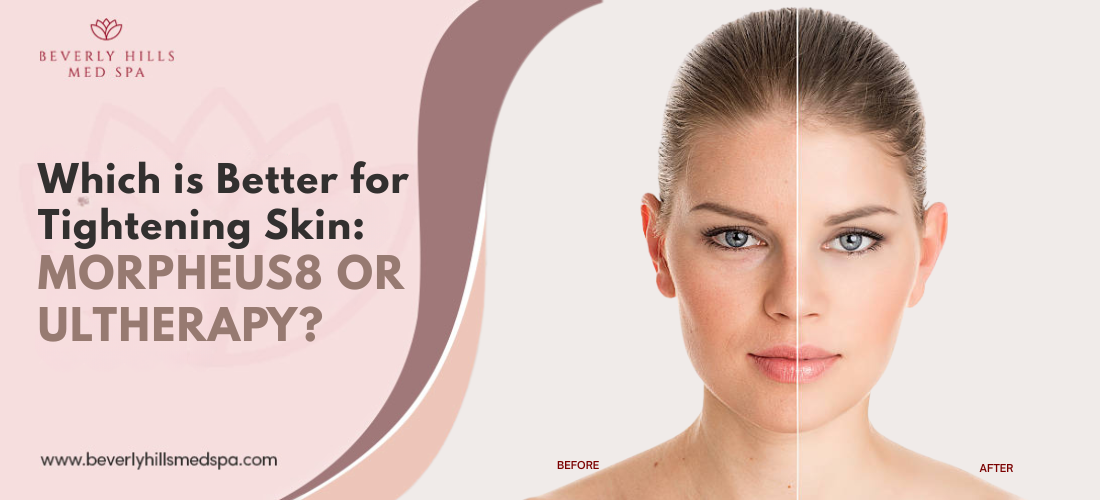 morpheus8 vs ultherapy