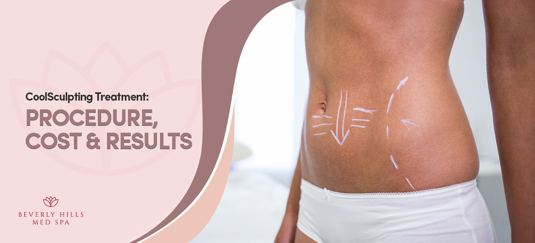 CoolSculpting Treatment