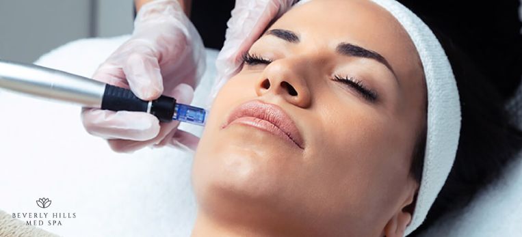 Is Microneedling Worth it