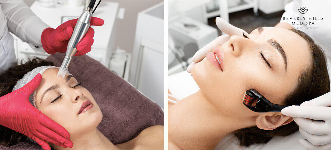 Microneedling vs Dermarolling