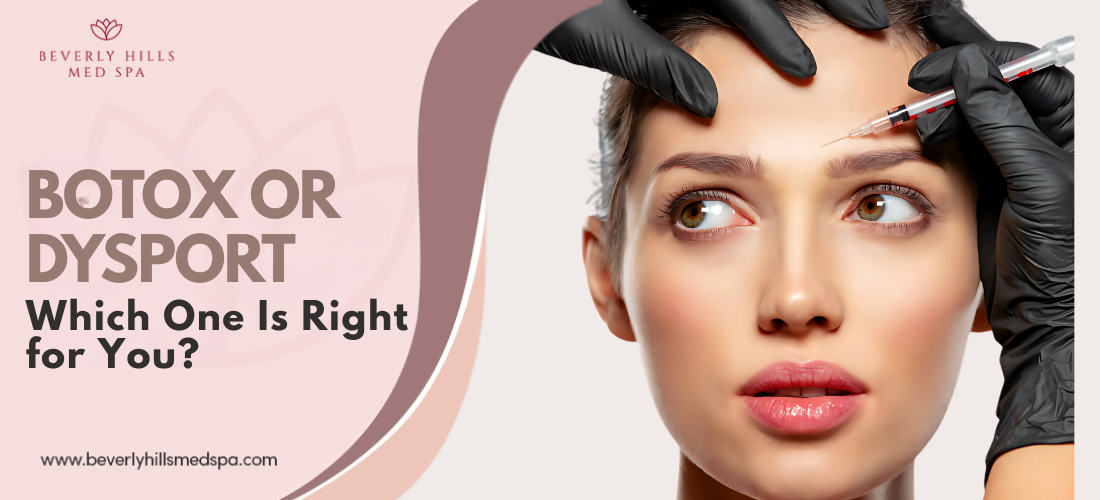 botox vs dysport